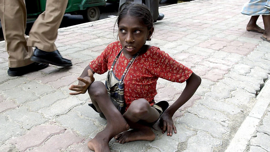 A Bangladeshi child with a physical disability sits on the ground.